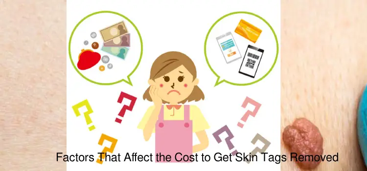 Factors That Affect the Cost to Get Skin Tags Removed