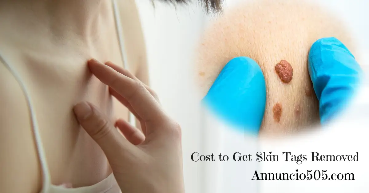 How Much Does It Cost to Get Skin Tags Removed? A Complete Guide